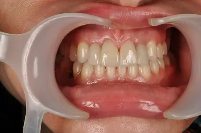 Ortodoncja Wolniewicz Clinic